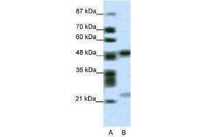 WB Suggested Anti-PHF11  Antibody Titration: 0. (PHF11 antibody  (Middle Region))