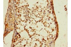 Immunohistochemistry of paraffin-embedded human testis tissue using ABIN7150696 at dilution of 1:100 (DSTYK antibody  (AA 680-929))