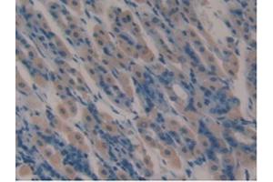 IHC-P analysis of Mouse Stomach Tissue, with DAB staining.