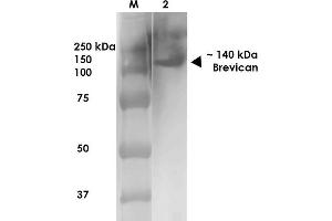 Western Blot analysis of Rat Brain Membrane showing detection of ~140 kDa Brevican protein using Mouse Anti-Brevican Monoclonal Antibody, Clone S294A-6 . (BCAN antibody  (AA 219-655) (Biotin))