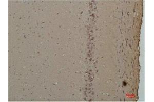 Immunohistochemistry (IHC) analysis of paraffin-embedded Rat Brain Tissue using CABP Rabbit Polyclonal Antibody diluted at 1:200. (S100G antibody)