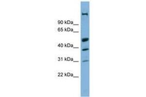 Image no. 1 for anti-CREB/ATF BZIP Transcription Factor (CREBZF) (AA 215-264) antibody (ABIN6742074) (CREBZF antibody  (AA 215-264))