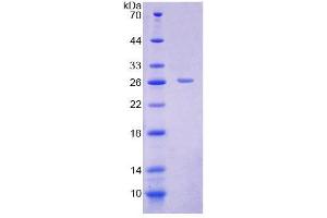 SDS-PAGE (SDS) image for Solute Carrier Family 25 (Carnitine/acylcarnitine Translocase), Member 20 (SLC25A20) (AA 1-211) protein (His tag) (ABIN4988801)