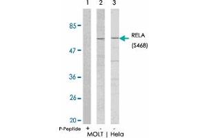 Western blot analysis of extracts from MOLT and HeLa cells using RELA (phospho S468) polyclonal antibody . (NF-kB p65 antibody  (pSer468))