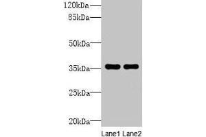 Western blot All lanes: NAIF1 antibody at 6 μg/mL Lane 1: Mouse brain tissue Lane 2: Mouse heart tissue Secondary Goat polyclonal to rabbit IgG at 1/10000 dilution Predicted band size: 36, 18 kDa Observed band size: 36 kDa (NAIF1 antibody  (AA 1-172))