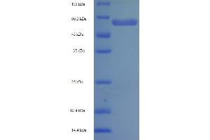 SDS-PAGE (SDS) image for 2-Oxoglutarate Dehydrogenase E1 (SUCA) (AA 41-423), (Isoform 3) protein (His-SUMO Tag) (ABIN5710039) (ODO1 Protein (AA 41-423, Isoform 3) (His-SUMO Tag))