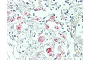 Formalin-fixed and paraffin-embedded H. (TMIGD2 antibody  (AA 119-147))