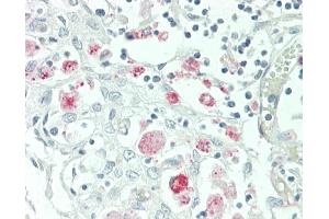 Formalin-fixed and paraffin-embedded H.