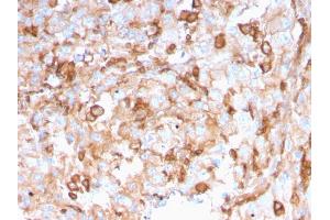 Formalin-fixed, paraffin-embedded human Kidney stained with PAI-RBP1 Mouse Monoclonal Antibody (SERBP1/3496). (SERBP1 antibody  (AA 3-139))