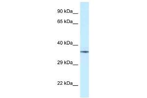 Western Blot showing NUDT6 antibody used at a concentration of 1 ug/ml against Fetal Brain Lysate (NUDT6 antibody  (Middle Region))