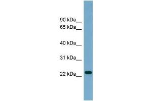 Human THP-1; WB Suggested Anti-ARL8B Antibody Titration: 0. (ARL8B antibody  (Middle Region))