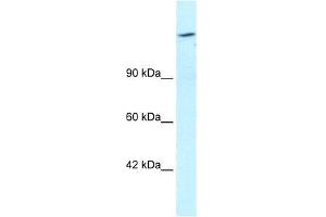 Human HepG2; WB Suggested Anti-ARID4A Antibody Titration: 1.