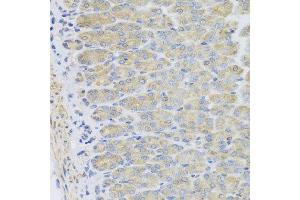 Immunohistochemistry of paraffin-embedded mouse stomach using EFHC1 antibody at dilution of 1:100 (x40 lens). (EFHC1 antibody)