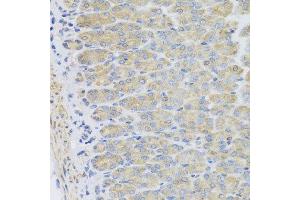 Immunohistochemistry of paraffin-embedded mouse stomach using EFHC1 antibody at dilution of 1:100 (x40 lens).