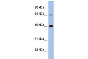 Image no. 1 for anti-Estrogen Receptor 1 (ESR1) (C-Term) antibody (ABIN6746024)