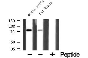 Western blot analysis of extracts of various tissue ,using HLX1 antibody. (HLX antibody  (Internal Region))