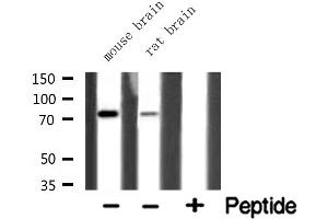 Western blot analysis of extracts of various tissue ,using HLX1 antibody.