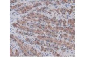 IHC-P analysis of Rat Stomach Tissue, with DAB staining. (Prothrombin antibody  (AA 201-323))