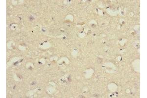 Immunohistochemistry of paraffin-embedded human brain tissue using ABIN7166554 at dilution of 1:100 (Protocadherin 1 antibody  (AA 515-715))
