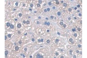 Detection of SNAP23 in Mouse Liver Tissue using Polyclonal Antibody to Synaptosomal Associated Protein 23 kDa (SNAP23) (SNAP23 antibody  (AA 1-210))
