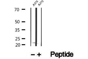 Western blot analysis of extracts of A375 cells, using RBBP9 antibody. (RBBP9 antibody  (Internal Region))