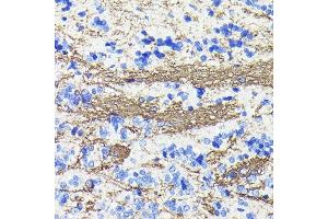 Immunohistochemistry of paraffin-embedded rat brain using CNPase Rabbit mAb (ABIN7265322) at dilution of 1:100 (40x lens). (Cnpase antibody)
