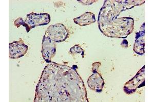Immunohistochemistry of paraffin-embedded human placenta tissue using ABIN7148365 at dilution of 1:100 (C4B antibody  (AA 1454-1744))