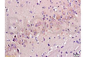 Formalin-fixed and paraffin embedded: rat brain tissue labeled with Anti-GAP-43 Polyclonal Antibody, Unconjugated (ABIN725555) at 1:300 followed by conjugation to the secondary antibody and DAB staining