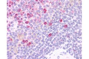 Anti-HCAR3 / GPR109B / HM74 antibody IHC of human spleen. (GPR109B antibody  (Cytoplasmic Domain))