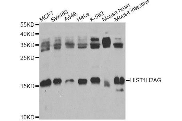 HIST1H2AG antibody