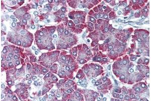 Pancreas, Human: Formalin-Fixed, Paraffin-Embedded (FFPE) (PTH2R antibody  (N-Term))