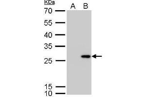 WB Image Calretinin antibody detects CALB2 protein by Western blot analysis. (Calretinin antibody)