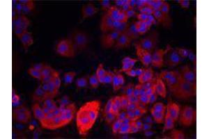 Immunofluorescence (IF) image for anti-Keratin 19 (KRT19) antibody (ABIN2664919) (Cytokeratin 19 antibody)
