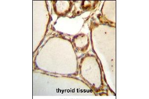 HJURP Antibody (C-term) (ABIN657329 and ABIN2846399) immunohistochemistry analysis in formalin fixed and paraffin embedded human thyroid tissue followed by peroxidase conjugation of the secondary antibody and DAB staining. (HJURP antibody  (C-Term))