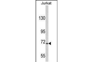 Western blot analysis of hUSP19-L1304 in Jurkat cell line lysates (35ug/lane) (USP19 antibody  (C-Term))