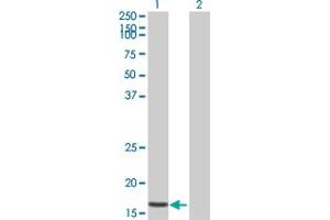 Western Blot analysis of STK10 expression in transfected 293T cell line by STK10 MaxPab polyclonal antibody. (STK10-A antibody  (AA 12-144))