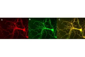 Indirect immunostaining of hippocampus neurons  (dilution 1 : 500) (NSF antibody  (AA 733-744))