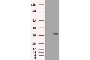 Image no. 3 for anti-3-hydroxyisobutyryl-CoA Hydrolase (HIBCH) antibody (ABIN1498658) (HIBCH antibody)