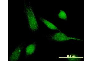 Immunofluorescence of monoclonal antibody to ABCC11 on HeLa cell.