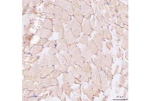 IHC analysis of CAV3 using anti-CAV3 antibody (ABIN6719285). (Caveolin 3 antibody  (AA 1-55))