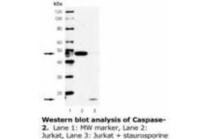 Image no. 1 for anti-Caspase 2, Apoptosis-Related Cysteine Peptidase (CASP2) antibody (ABIN331472) (Caspase 2 antibody)