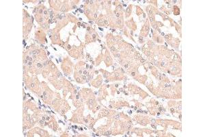 Immunohistochemistry of paraffin-embedded Human stomach using ABCC5 Polyclonal Antibody at dilution of 1:100 (40x lens). (ABCC5 antibody)