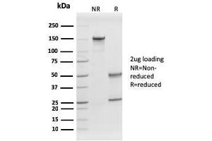 SDS-PAGE Analysis Purified Prohibitin Mouse Monoclonal Antibody (PHB/1882).