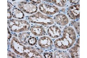 Immunohistochemical staining of paraffin-embedded liver tissue using anti-LIPG mouse monoclonal antibody. (LIPG antibody)