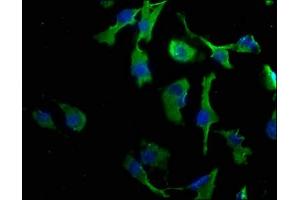 Immunofluorescence staining of U251 cells with ABIN7147863 at 1:50, counter-stained with DAPI. (CLDND1 antibody  (AA 26-140))