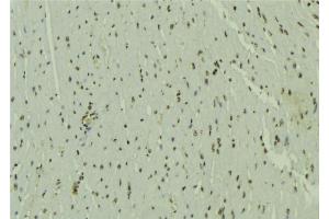 ABIN6272476 at 1/100 staining Mouse muscle tissue by IHC-P.