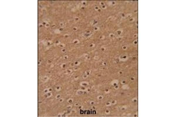 ZBTB2 antibody  (C-Term)