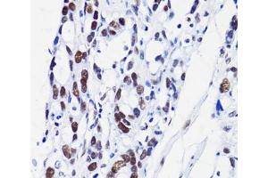 Immunohistochemistry (Paraffin-embedded Sections) (IHC (p)) image for anti-Histone H2B (acLys15) antibody (ABIN7258526)