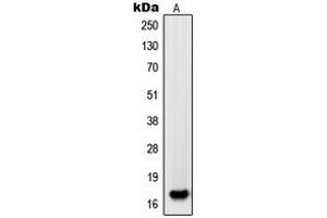 Western blot analysis of PDGFA expression in HL60 (A) whole cell lysates. (PDGFA antibody  (Center))