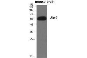Western Blot (WB) analysis of specific cells using Akt2 Polyclonal Antibody. (AKT2 antibody  (Ser138))